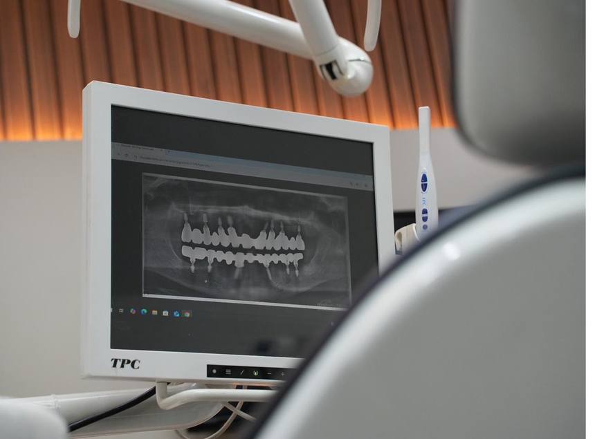 Treatment unit and digital panoramic imaging