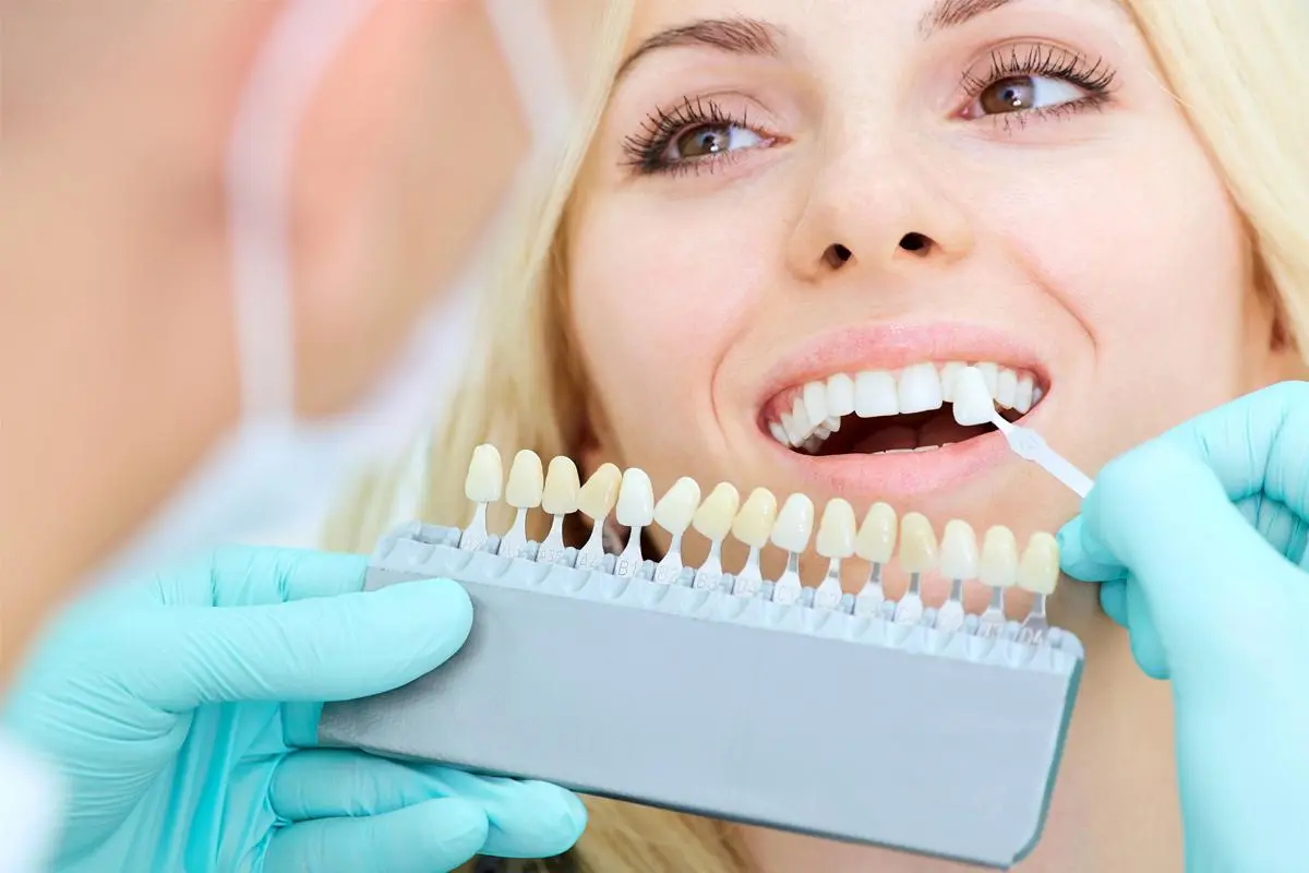 Digital Smile Design